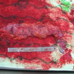 Detailed autopsy of Chinese woman