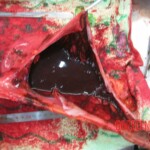 Detailed autopsy of Chinese woman