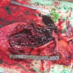 Detailed autopsy of Chinese woman