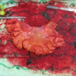 Detailed autopsy of Chinese woman