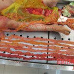 Detailed autopsy of Chinese woman