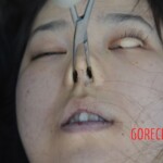 Autopsy of Chinese woman