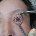 Detailed autopsy of Chinese woman