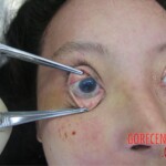 Detailed autopsy of Chinese woman