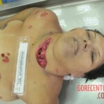 Stabbed woman in morgue