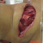 Stabbed woman in morgue