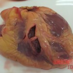 Stabbed woman in morgue