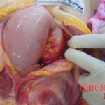 Autopsy of young woman