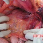 Autopsy of young woman