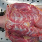 Autopsy of young woman