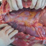 Autopsy of young woman