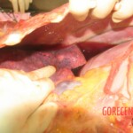 Autopsy of young woman