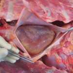 Autopsy of young woman