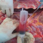 Autopsy of young woman