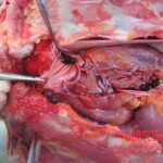 Autopsy of young woman