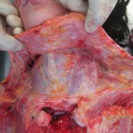 Autopsy of young woman