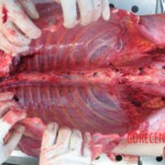 Autopsy of young woman