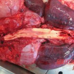 Autopsy of young woman