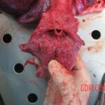 Autopsy of young woman