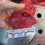 Autopsy of young woman