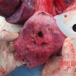 Autopsy of young woman