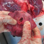 Autopsy of young woman