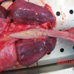 Autopsy of young woman