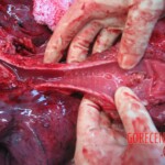 Autopsy of young woman