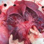 Autopsy of young woman