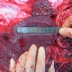 Autopsy of young woman