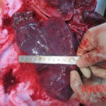 Autopsy of young woman