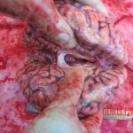 Autopsy of young woman