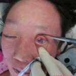 Autopsy of young woman