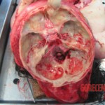 Autopsy of young woman