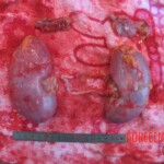 Autopsy of young woman