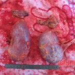 Autopsy of young woman