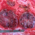 Autopsy of young woman