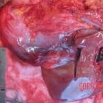 Autopsy of young woman