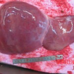 Autopsy of young woman