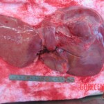 Autopsy of young woman