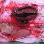 Autopsy of young woman