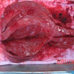 Autopsy of young woman