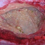 Autopsy of young woman