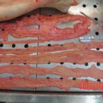 Autopsy of young woman