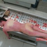 Autopsy of young woman