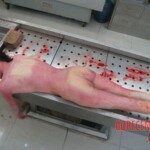 Autopsy of young woman