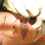 Autopsy of young woman