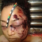 Brutally raped pregnant Chinese woman in morgue