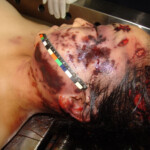 Brutally raped pregnant Chinese woman in morgue