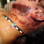 Brutally raped pregnant Chinese woman in morgue